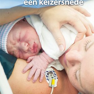 Keizersnede (PDF)